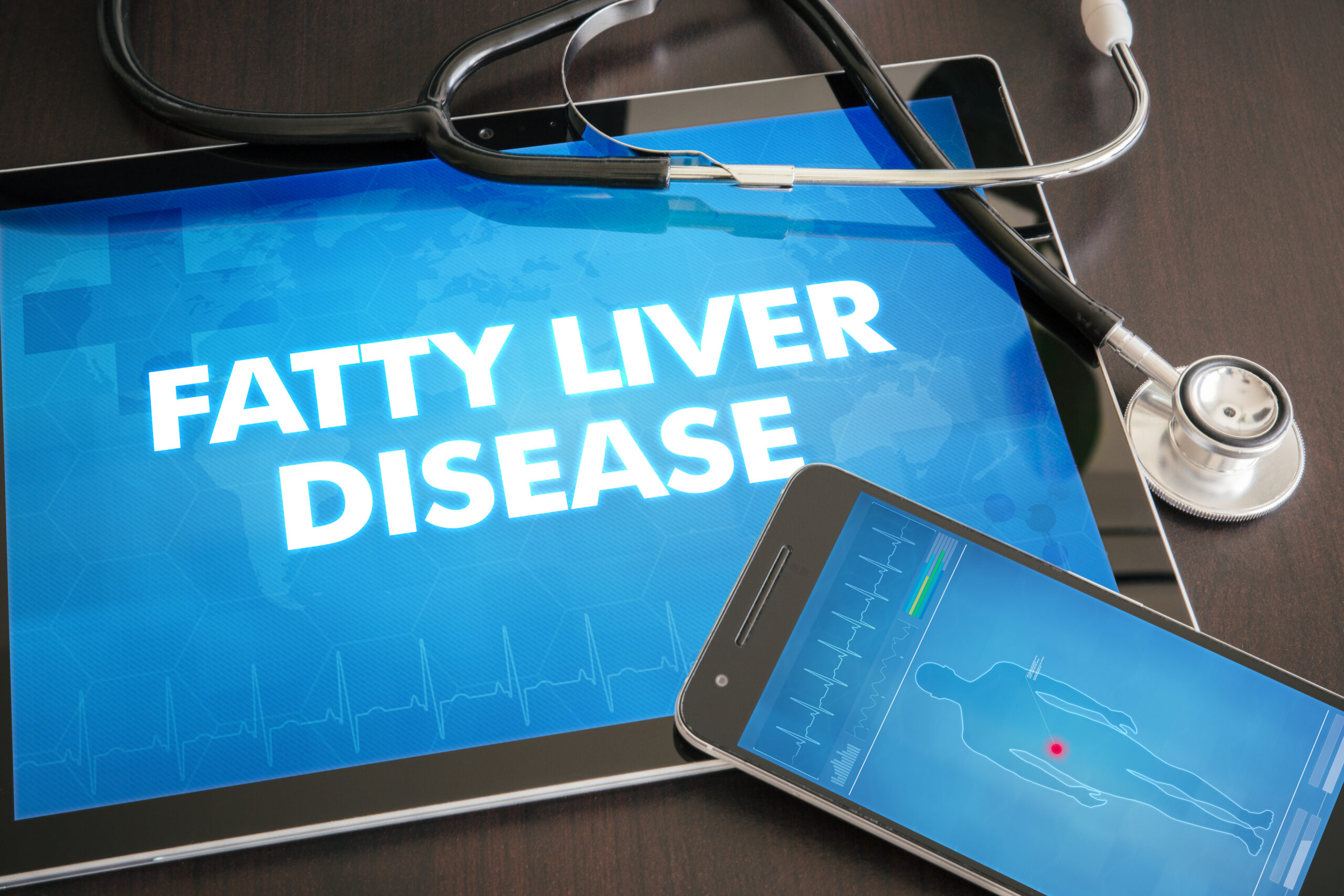 Fatty Liver Disease